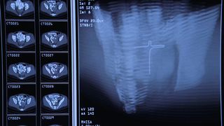 72. Доктор Хаус (2004 — 2012)